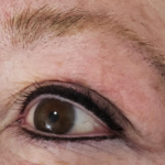 Permanent Eyeliner in Boise, Idaho - After